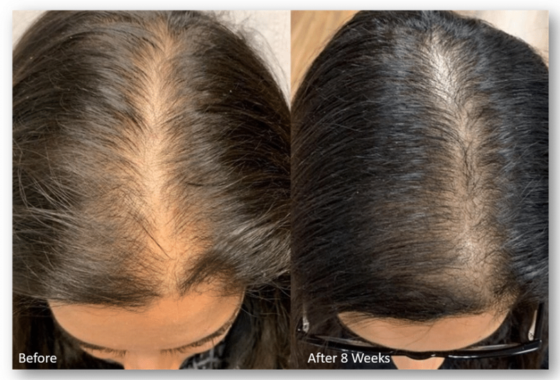 Hair Regrowth Oil & Shampoo